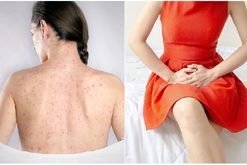 Dấu Hiệu Điển Hình Nhận Biết Triệu Chứng Bệnh Xã Hội Pleiku Gia Lai