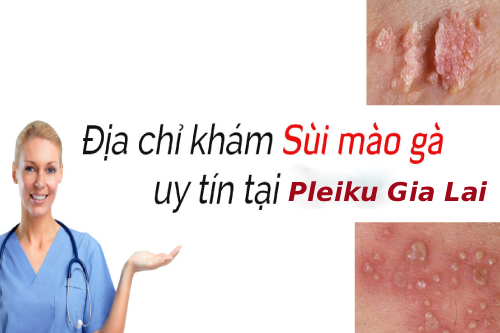 Địa Chỉ Khám Chữa Bệnh Sùi Mào Gà Uy Tín Pleiku Gia Lai