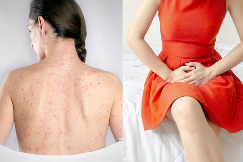 Mẹ Bầu Mắc Bệnh Giang Mai Có Nguy Cơ Lây Nhiễm Sang Thai Nhi Mẹ Bầu Mắc Bệnh Giang Mai Có Nguy Cơ Lây Nhiễm Sang Thai Nhi