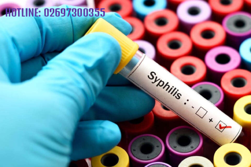 Xét Nghiệm Giang Mai Âm Tính Là Như Thế Nào Pleiku Gia Lai? Xét Nghiệm Giang Mai Âm Tính Là Như Thế Nào Pleiku Gia Lai?