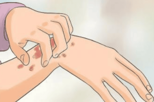 Yêu Bằng Đường Miệng Có Lây Bệnh Giang Mai Không?